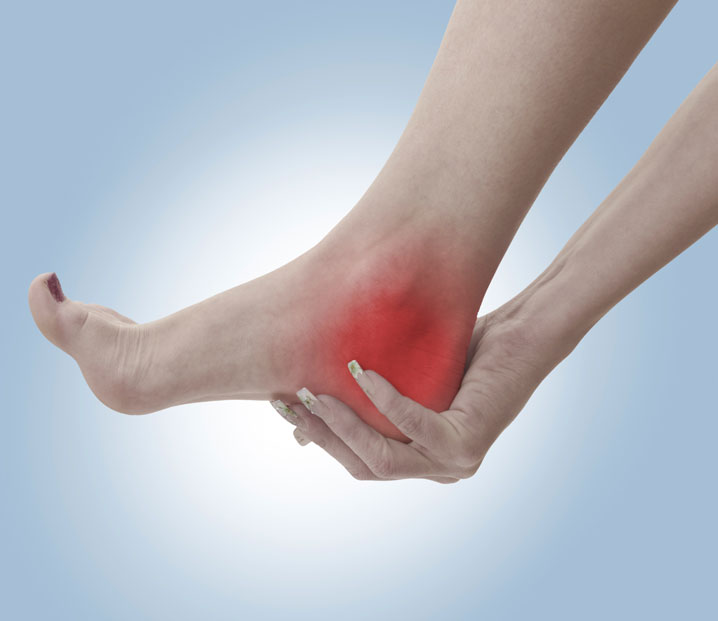 Plantar Fasciitis Chiropractors Seattle